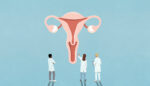 The Freedom to Choose Hysterectomy